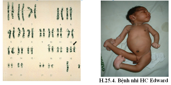 Bài 2. Di truyền y học